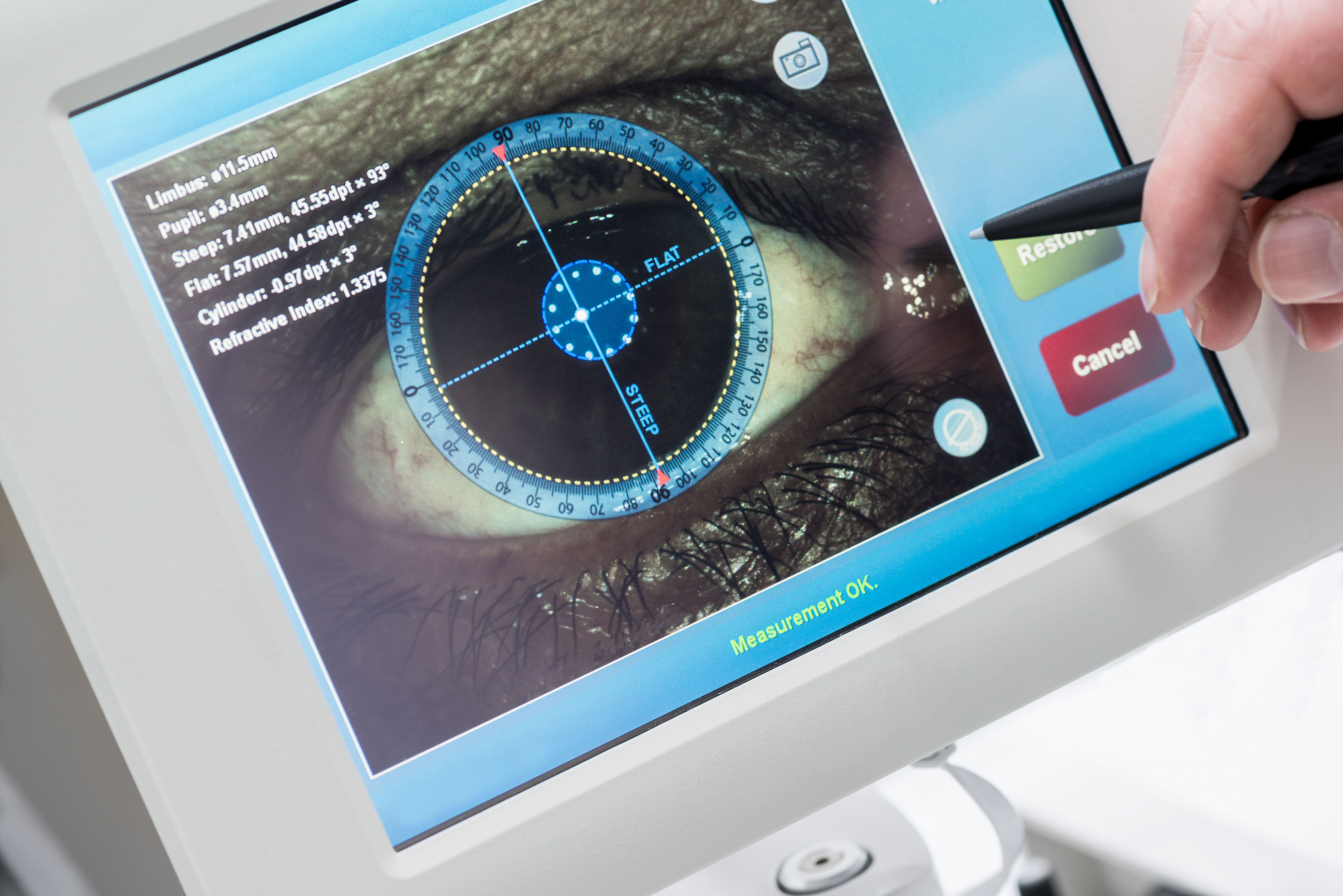Eye Conditions that Eye Telemedicine Can Treat